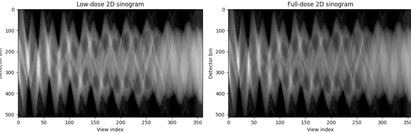 Low-dose and full-dose sinogram